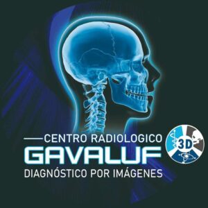 GAVALUF